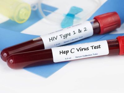 Тест на гепатит С и ВИЧ