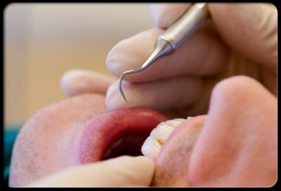 Заражение гепатитом С у стоматолога