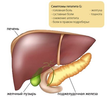 Симптомы гепатита G