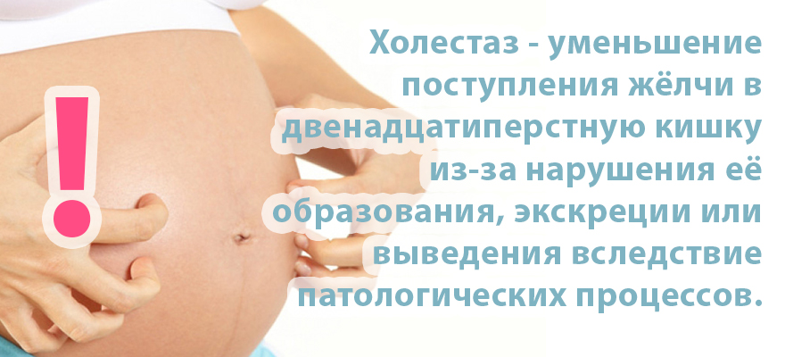 Холестаз беременных