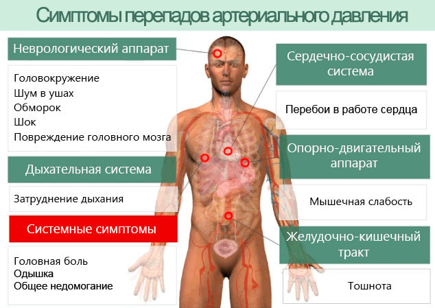 Симптомы перепадов артериального давления