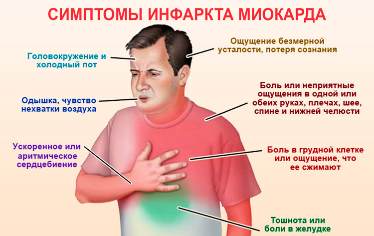 Симптомы инфаркта