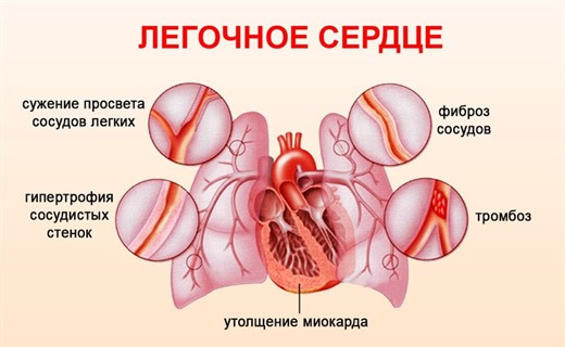 Физиология легочного сердца