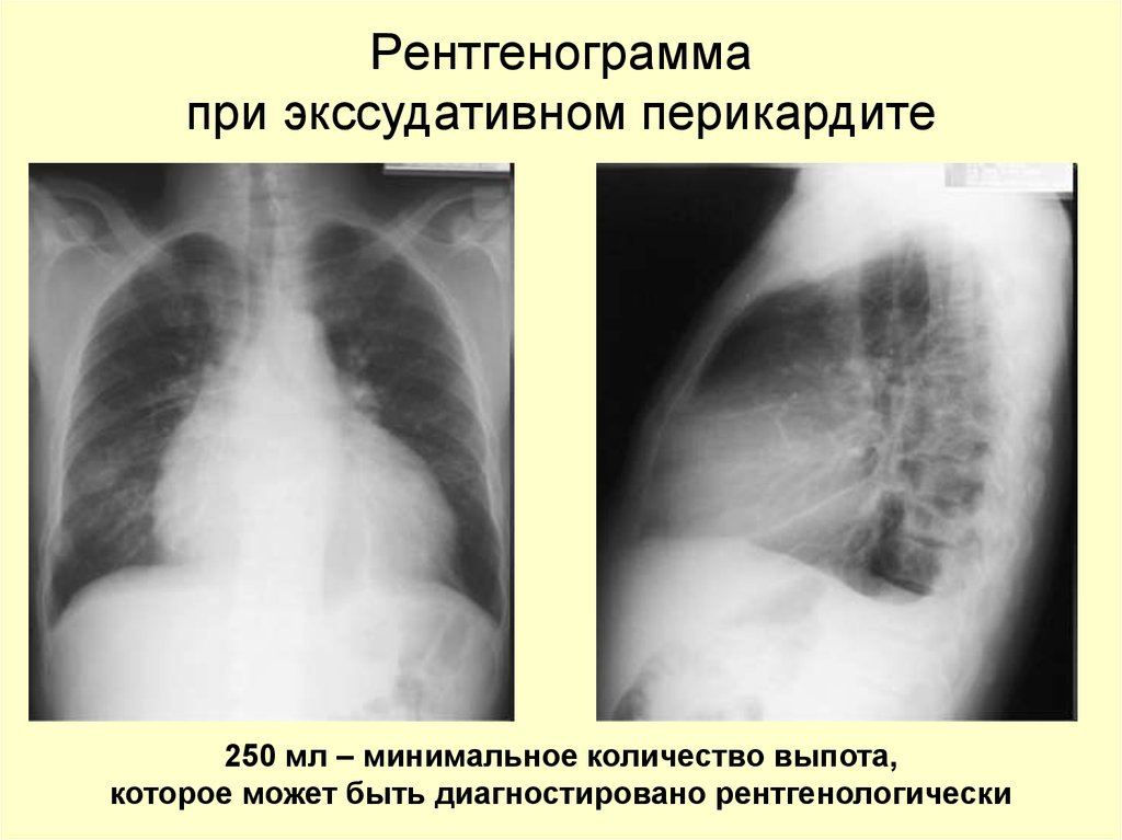 Рентгенограмма