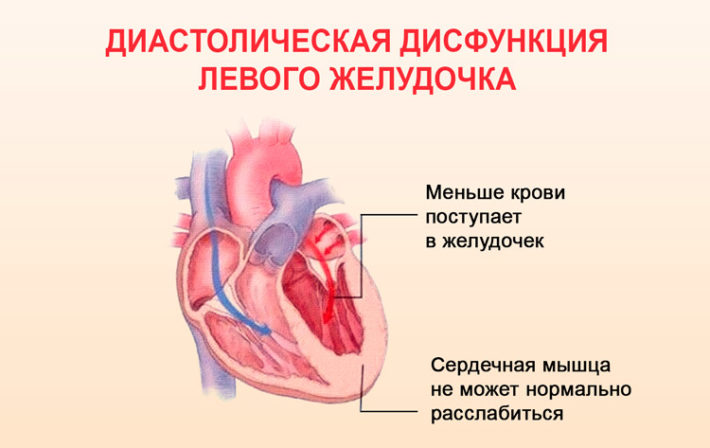 Раеном: инструкция по применению, аналоги, цена препарата от сердечной .
