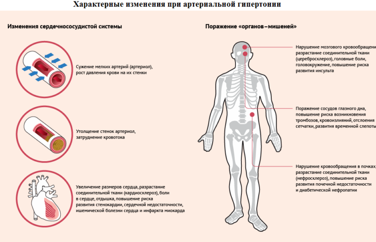 Повышенное давление на фоне стресса