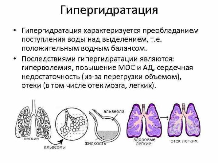 Клиническая картина сердечной астмы