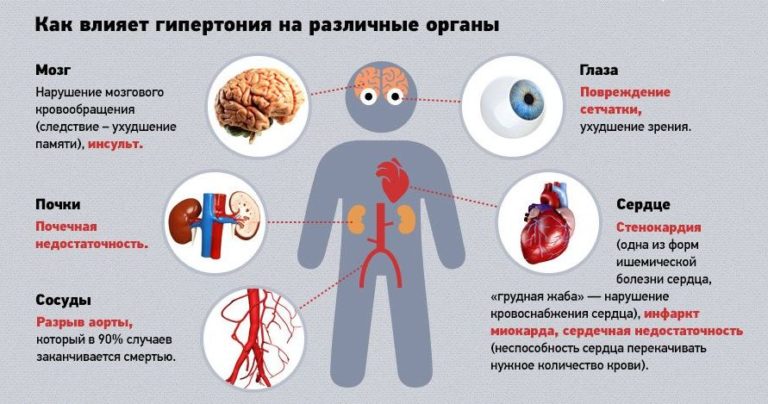 Дэп на фоне гипертонической болезни