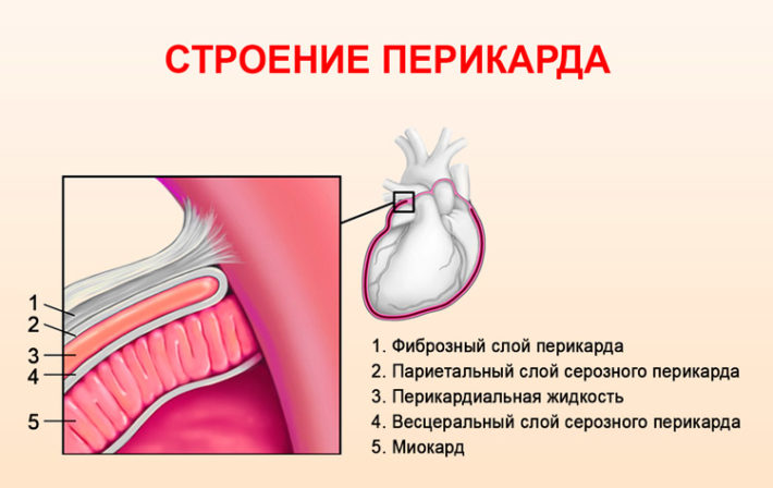 Воспалительные заболевания сердца презентация