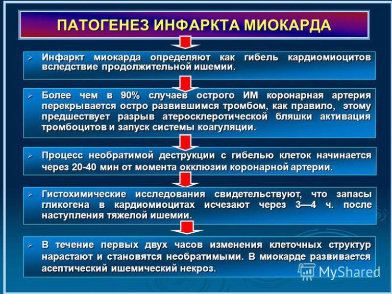 Диагностика инфаркта миокарда картинки