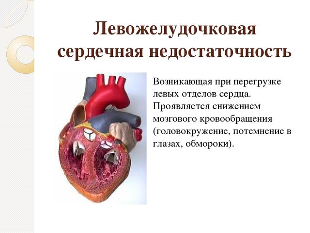 Изображение - Таблетки от давления ордисс отзывы levozheludochkovaya-nedostatochnost