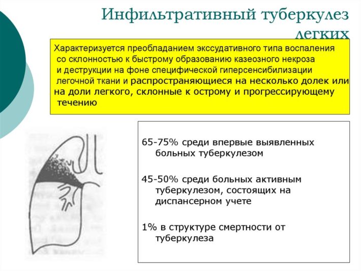 Неотложные состояния при туберкулезе презентация