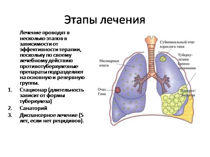 Этапы лечения туберкулеза