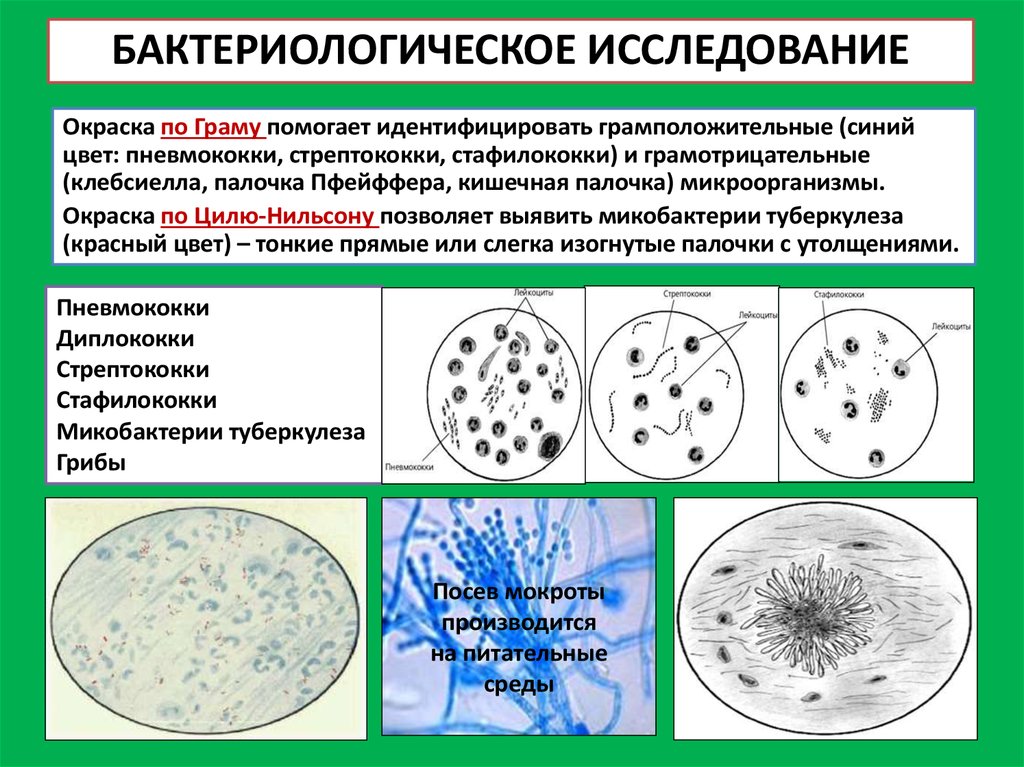 Бактериологическое исследование
