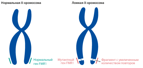 Ген FMR1